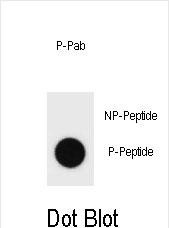 Dot blot analysis of Phospho-mouse BAD-S161 Antibody Phospho-specific Pab (Cat. #AP3777c) on nitrocellulose membrane. 50ng of Phospho-peptide or Non Phospho-peptide per dot were adsorbed. Antibody working concentrations are 0.6ug per ml.