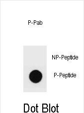 Dot blot analysis of Phospho-mouse ERBB2-S999 Antibody Phospho-specific Pab (Cat. #AP3781f) on nitrocellulose membrane. 50ng of Phospho-peptide or Non Phospho-peptide per dot were adsorbed. Antibody working concentrations are 0.6ug per ml.