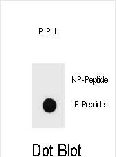 Dot blot analysis of Phospho-KIT-T718 Antibody Phospho-specific Pab (Cat. #AP3784g) on nitrocellulose membrane. 50ng of Phospho-peptide or Non Phospho-peptide per dot were adsorbed. Antibody working concentrations are 0.6ug per ml.