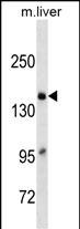 A2M Antibody (C-term)(Ascites)(Cat. #AM2102a) western blot analysis in mouse Liver tissue lysates (35?g/lane).This demonstrates the A2M antibody detected the A2M protein (arrow).