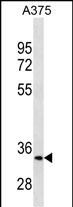 MC1R Antibody (Center)(Cat. #AM2107a) western blot analysis in A375 cell line lysates (35?g/lane).This demonstrates the MC1R antibody detected the MC1R protein (arrow).