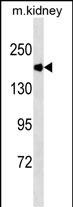 ACE Antibody (Ascites)(Cat. #AM2111a) western blot analysis in mouse kidney tissue lysates (35?g/lane).This demonstrates the ACE antibody detected the ACE protein (arrow).