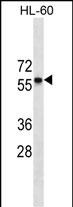 CCR7 Antibody (N-term)(Ascites)(Cat. #AM2119a) western blot analysis in HL-60 cell line lysates (35?g/lane).This demonstrates the CCR7 antibody detected the CCR7 protein (arrow).