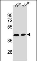 ADA Antibody (C-term)(Cat. #AM2128b) western blot analysis in CEM,Jurkat cell line lysates (35?g/lane).This demonstrates the ADA antibody detected the ADA protein (arrow).