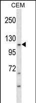 KIT Antibody(Ascites)(Cat. #AM2137a) western blot analysis in CEM cell line lysates (35?g/lane).This demonstrates the KIT antibody detected the KIT protein (arrow).