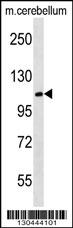 WB - MBD6 Antibody (C-term) AP18913B
