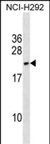 WB - DYDC2 Antibody (C-term) AP18917b
