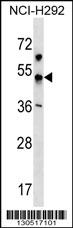 WB - KCNJ18 Antibody (N-term) AP18921a