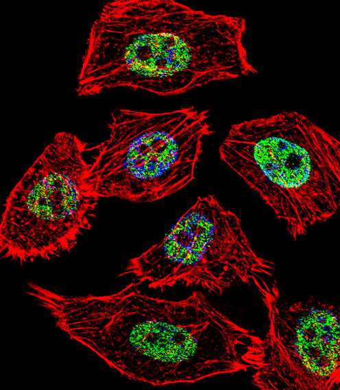 Fluorescent confocal image of U251 cell stained with JUN Antibody (Center T93)(Cat#AP18924c).U251 cells were fixed with 4% PFA (20 min), permeabilized with Triton X-100 (0.1%, 10 min), then incubated with JUN primary antibody (1:25, 1 h at 37?). For secondary antibody, Alexa Fluor� 488 conjugated donkey anti-rabbit antibody (green) was used (1:400, 50 min at 37?).Cytoplasmic actin was counterstained with Alexa Fluor� 555 (red) conjugated Phalloidin (7units/ml, 1 h at 37?). Nuclei were counterstained with DAPI (blue) (10 �g/ml, 10 min). JUN immunoreactivity is localized to Nucleus significantly.