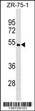 WB - CHST5 Antibody (C-term) AP18949b