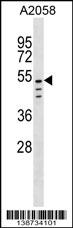 WB - CLEC18C Antibody (C-term) AP18950b