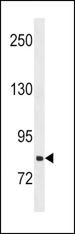 WB - SLCO1B3 Antibody (C-term) AP18964b