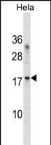 WB - RPL36A Antibody (C-term) AP18971B