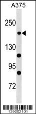 WB - POLR1A Antibody (C-term) AP18976b