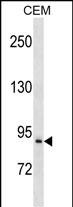 PREP Antibody (Center) (Cat. #AP18992c) western blot analysis in CEM cell line lysates (35ug/lane).This demonstrates the PREP antibody detected the PREP protein (arrow).