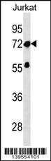 WB - ZNF286A Antibody (Center) AP19017c