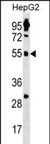 WB - ZNF500 Antibody (N-term) AP19018a
