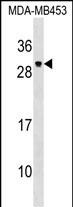 PDF Antibody (Center) (Cat. #AP19023c) western blot analysis in MDA-MB453 cell line lysates (35ug/lane).This demonstrates the PDF antibody detected the PDF protein (arrow).