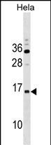 WB - RPP14 Antibody (C-term) AP19036B