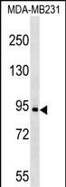 KIT Antibody (C-term S821/Y823) (Cat. #AP19037b) western blot analysis in MDA-MB231 cell line lysates (35ug/lane).This demonstrates the KIT antibody detected the KIT protein (arrow).