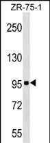 KIT Antibody (Center S713) (Cat. #AP19042c) western blot analysis in ZR-75-1 cell line lysates (35ug/lane).This demonstrates the KIT antibody detected the KIT protein (arrow).