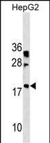 WB - LBX2 Antibody (Center) AP19043c