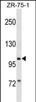 WB - PIWIL2 Antibody (N-term) AP19056a