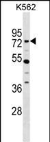 WB - ZNF133 Antibody (N-term) AP19063a