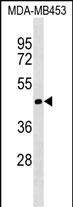 TIMM50 Antibody (N-term) (Cat. #AP19064a) western blot analysis in MDA-MB453 cell line lysates (35ug/lane).This demonstrates the TIMM50 antibody detected the TIMM50 protein (arrow).