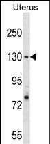 RFC1 Antibody (N-term) (Cat. #AP19110a) western blot analysis in Uterus tissue lysates (35ug/lane).This demonstrates the RFC1 antibody detected the RFC1 protein (arrow).