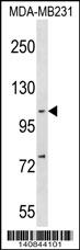 NFKB(p105) Antibody (C-term S933) (Cat. #AP19121b) western blot analysis in MDA-MB231 cell line lysates (35ug/lane).This demonstrates the NFKB antibody detected the NFKB protein (arrow).
