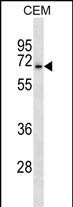 ACCN3 Antibody (N-term) (Cat. #AP19124a) western blot analysis in CEM cell line lysates (35ug/lane).This demonstrates the ACCN3 antibody detected the ACCN3 protein (arrow).