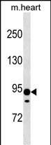 WB - XYLT2 Antibody (N-term) AP19159A