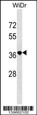 WB - RN3L1 Antibody (C-term) AP19182b