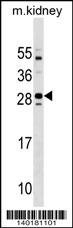 WB - Mouse Tmem125 Antibody (N-term) AP19231a
