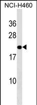 TMED10 Antibody (C-term) (Cat. #AP19254b) western blot analysis in NCI-H460 cell line lysates (35ug/lane).This demonstrates the TMED10 antibody detected the TMED10 protein (arrow).