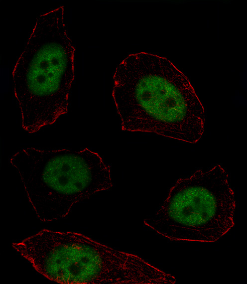 Fluorescent image of U251 cell stained with MSX1 Antibody (Center)(Cat#AP19261c).U251 cells were fixed with 4% PFA (20 min), permeabilized with Triton X-100 (0.1%, 10 min), then incubated with MSX1 primary antibody (1:25, 1 h at 37?). For secondary antibody, Alexa Fluor� 488 conjugated donkey anti-rabbit antibody (green) was used (1:400, 50 min at 37?).Cytoplasmic actin was counterstained with Alexa Fluor� 555 (red) conjugated Phalloidin (7units/ml, 1 h at 37?).MSX1 immunoreactivity is localized to Nucleus significantly.