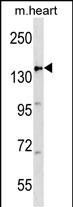 APC Antibody (Center)(Cat. #AP19274c) western blot analysis in mouse heart tissue lysates (35ug/lane).This demonstrates the APC antibody detected the APC protein (arrow).