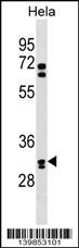 WB - OR6B2 Antibody (C-term) AP19297b