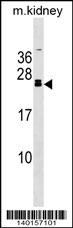 FGF20 Antibody (C-term)(Cat. #AP19307b) western blot analysis in mouse kidney tissue lysates (35ug/lane).This demonstrates the FGF20 antibody detected the FGF20 protein (arrow).