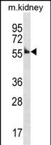 Mouse Ccna1 Antibody (Center)(Cat. #AP19342c) western blot analysis in mouse kidney tissue lysates (35ug/lane).This demonstrates the Ccna1 antibody detected the Ccna1 protein (arrow).