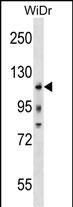 KIT Antibody (Center Y568/Y570)(Cat. #AP19355c) western blot analysis in WiDr cell line lysates (35ug/lane).This demonstrates the KIT antibody detected the KIT protein (arrow).