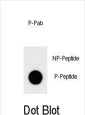 Dot blot analysis of Phospho-rat BAD-S109 Antibody Phospho-specific Pab (Cat. #AP3777n) on nitrocellulose membrane. 50ng of Phospho-peptide or Non Phospho-peptide per dot were adsorbed. Antibody working concentrations are 0.6ug per ml.