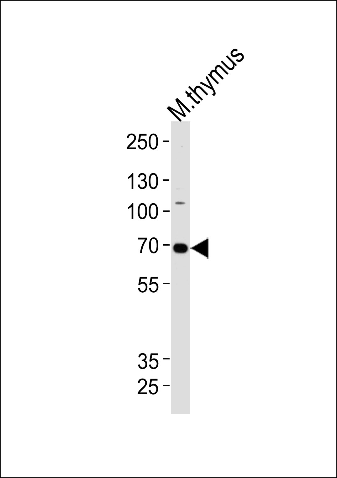 WB - Mouse Ephb6 Antibody(Center) AP19421c