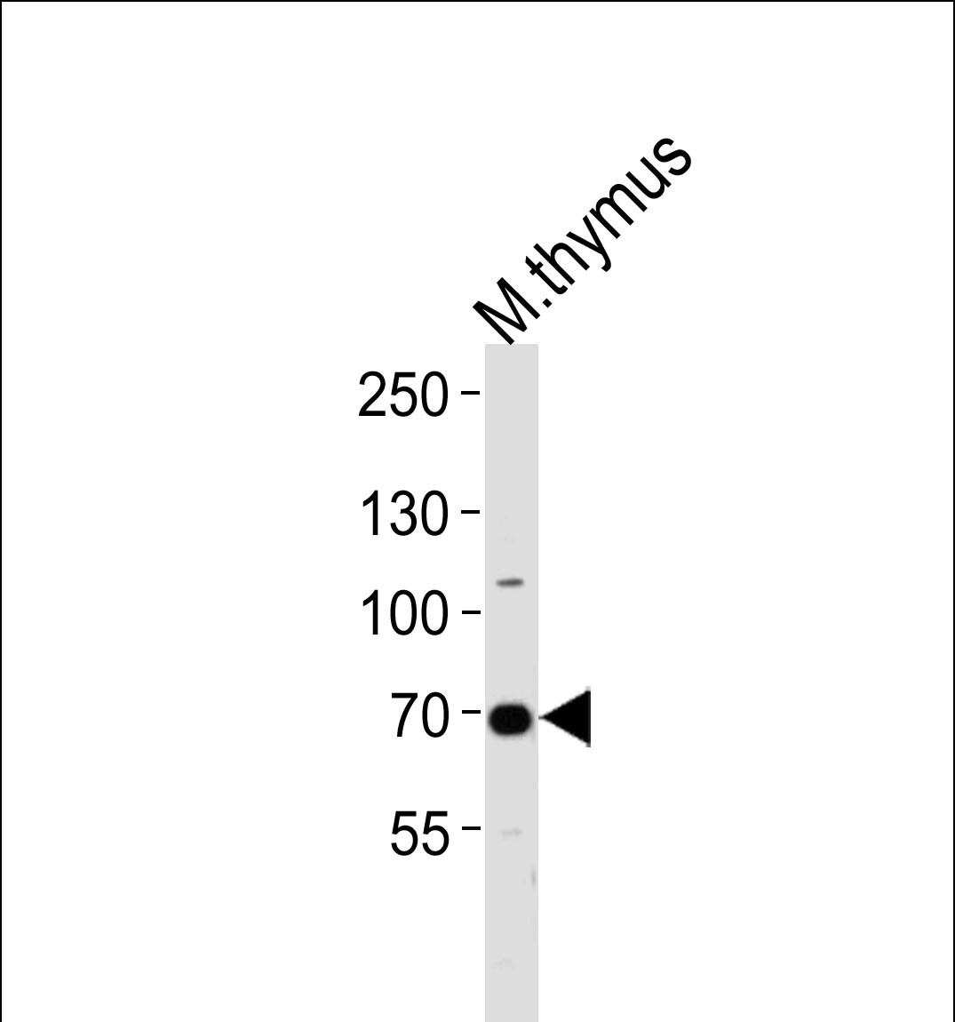 WB - Mouse Ephb6 Antibody(Center) AP19421c