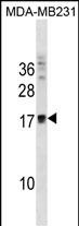 ANKRD37 Antibody (C-term) (Cat. #AP19439b) western blot analysis in MDA-MB231 cell line lysates (35ug/lane).This demonstrates the ANKRD37 antibody detected the ANKRD37 protein (arrow).