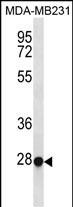 TFEC Antibody (Center) (Cat. #AP19475c) western blot analysis in MDA-MB231 cell line lysates (35ug/lane).This demonstrates the TFEC antibody detected the TFEC protein (arrow).