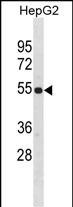 WB - ZNF101 Antibody(Center) AP19482c