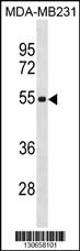 ZSCAN5C Antibody (Center) (Cat. #AP19578c) western blot analysis in MDA-MB231 cell line lysates (35ug/lane).This demonstrates the ZSCAN5C antibody detected the ZSCAN5C protein (arrow).