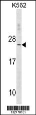 WB - TNNC2 Antibody(C-term) AP19581b